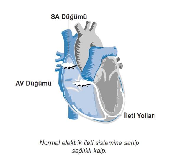 Kalp pili takılma işleminin riskleri nelerdir?